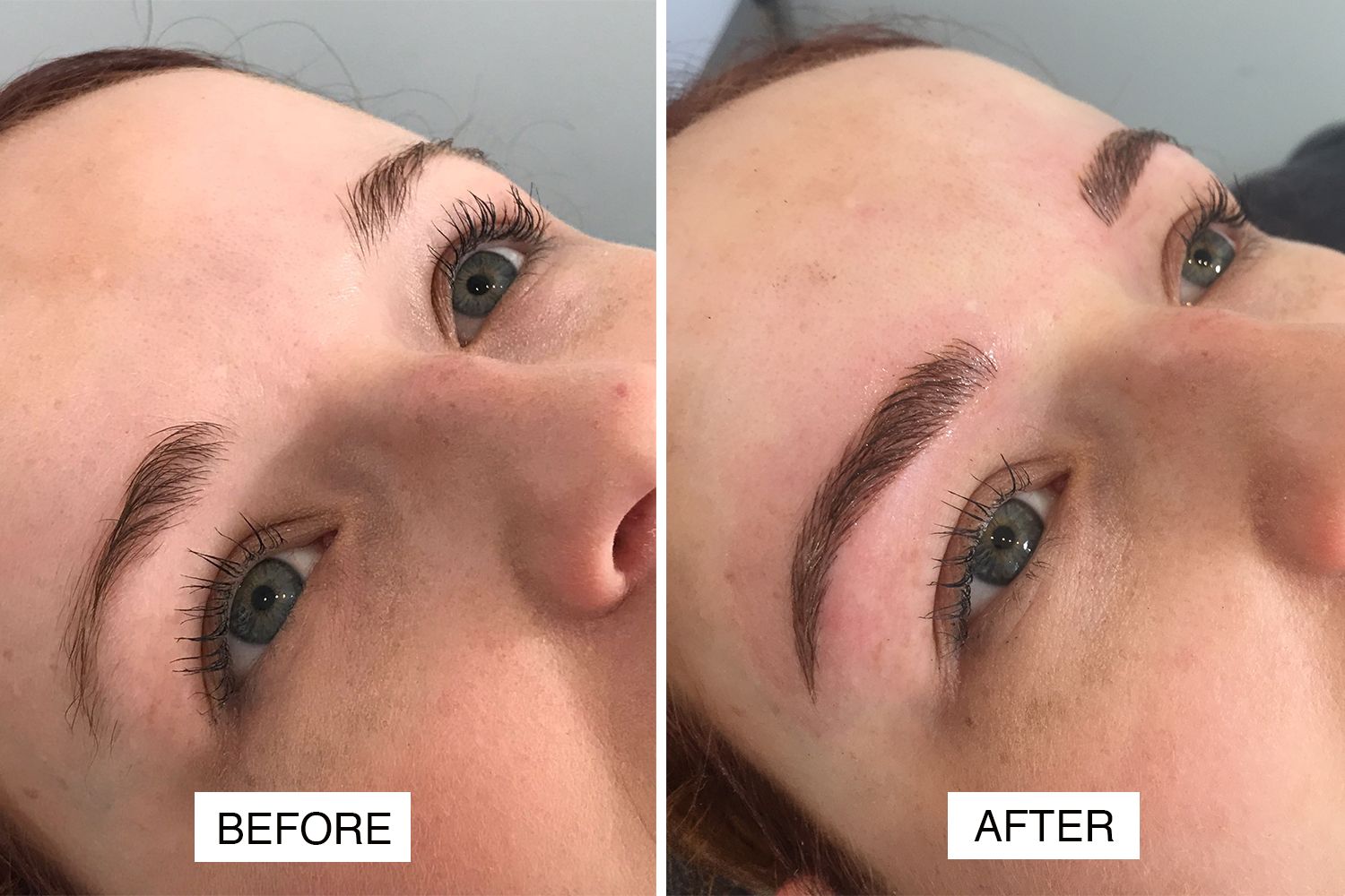 Micro-Blading Of Eyebrows