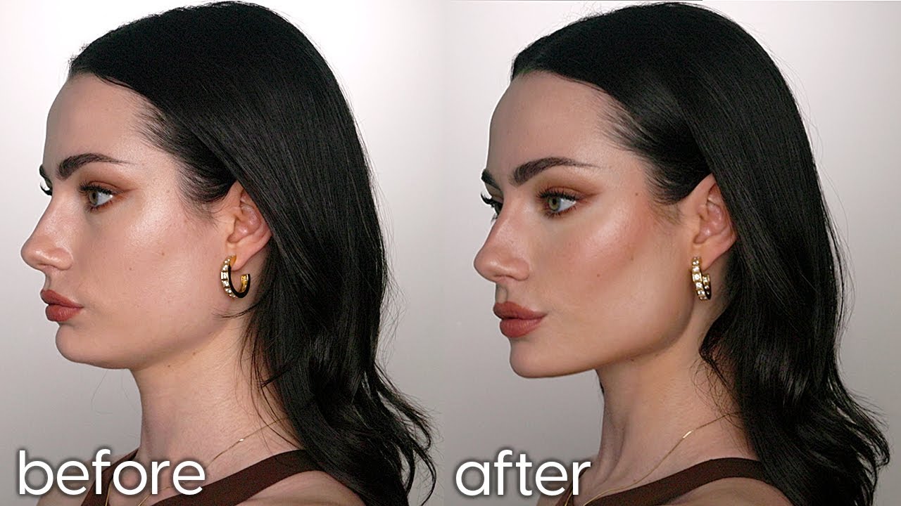 Jawline Contouring